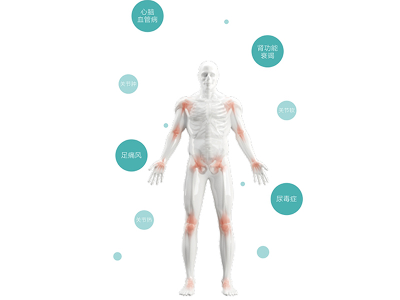 痛風(fēng)個(gè)體化用藥基因檢測